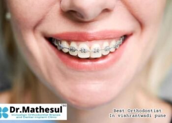 Invisalign treatment Pune, Clear aligners Vishrantwadi, Dr. Mathesul dental clinic, Best dentist in Kalyani Nagar, Braces specialist East Pune, Dental implants Pune, Orthodontic clinic near me, Ceramic and metal braces Pune, Smile makeover Vishrantwadi, Expert orthodontist in Pune,Best Orthodontist in Vishrantwadi Pune