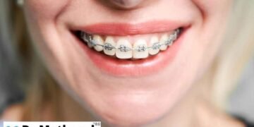 Invisalign treatment Pune, Clear aligners Vishrantwadi, Dr. Mathesul dental clinic, Best dentist in Kalyani Nagar, Braces specialist East Pune, Dental implants Pune, Orthodontic clinic near me, Ceramic and metal braces Pune, Smile makeover Vishrantwadi, Expert orthodontist in Pune,Best Orthodontist in Vishrantwadi Pune