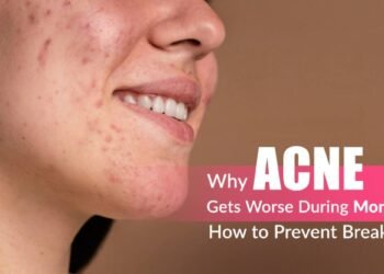 Monsoon Acne, Rainy Season Breakouts, Acne Prevention Tips, Clogged Pores Humidity, Dermapuritys, Oily Skin Monsoon Care, Acne Treatment